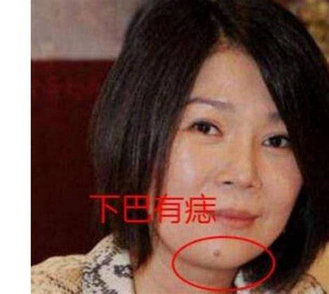 女人下巴有痣|女人下巴痣相解析 下巴长痣的寓意与命运